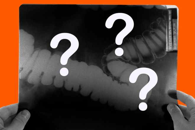 6个月「废功」20%癌症检出率！开元棋牌柳叶刀惊曝：AI让医生(图8)