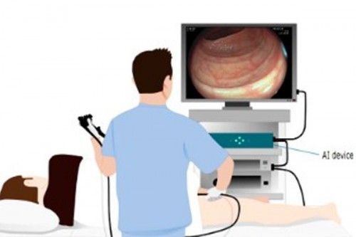 6个月「废功」20%癌症检出率！开元棋牌柳叶刀惊曝：AI让医生(图7)